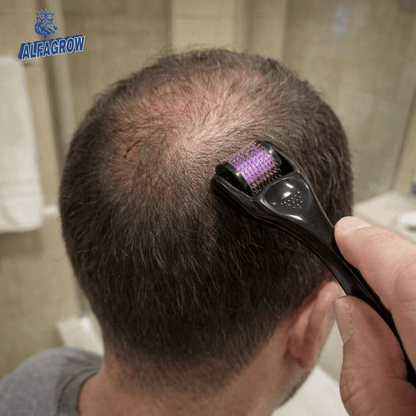 Dermarroller Capilar 0,5MM | ALFAGROW®