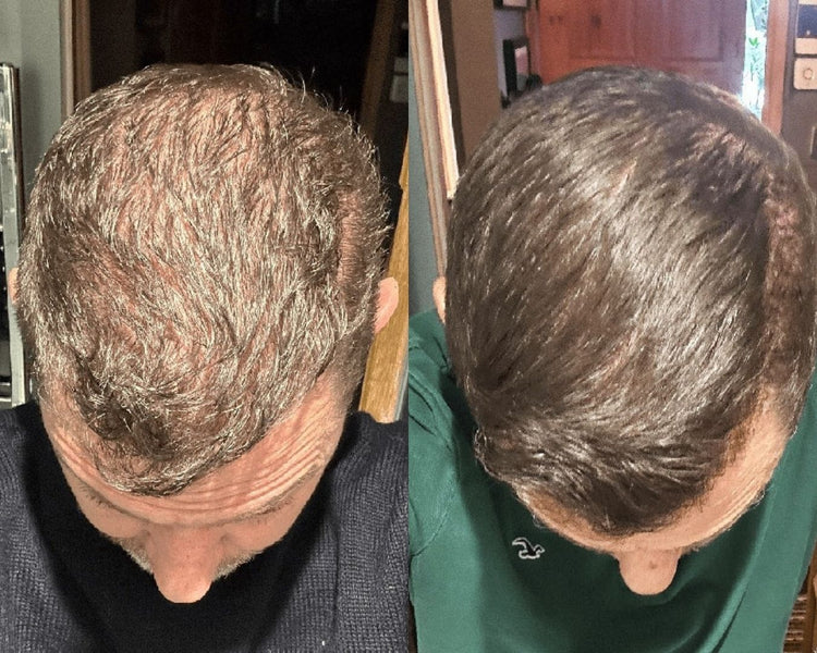 Antes y después