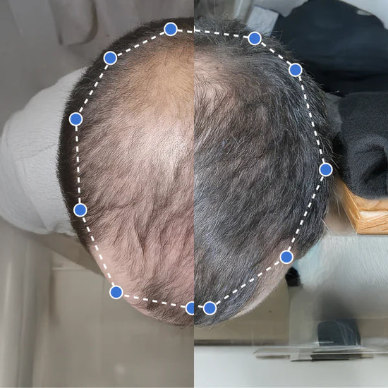 Transformación antes y después 2