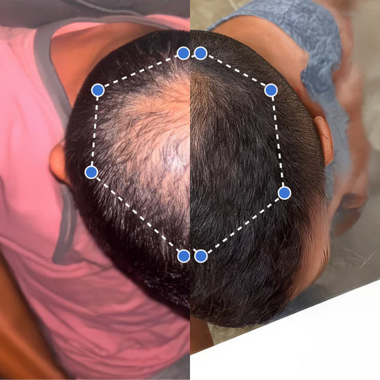 Transformación antes y después 1