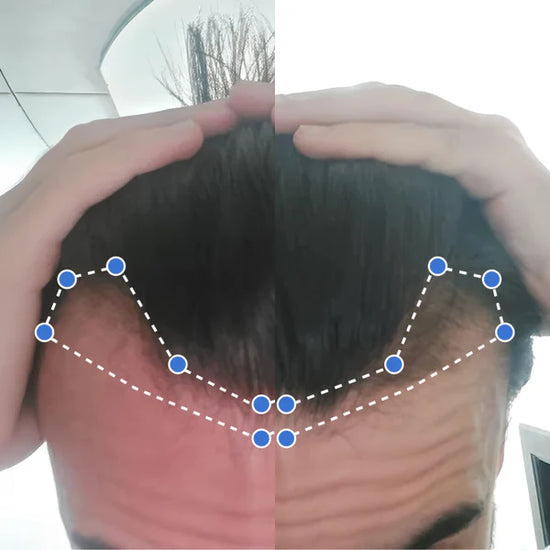 Transformación antes y después 6