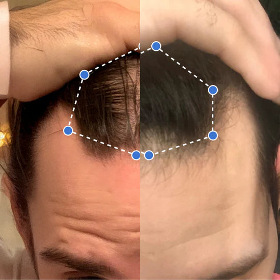 Transformación antes y después 7