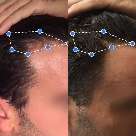 Transformación antes y después 5