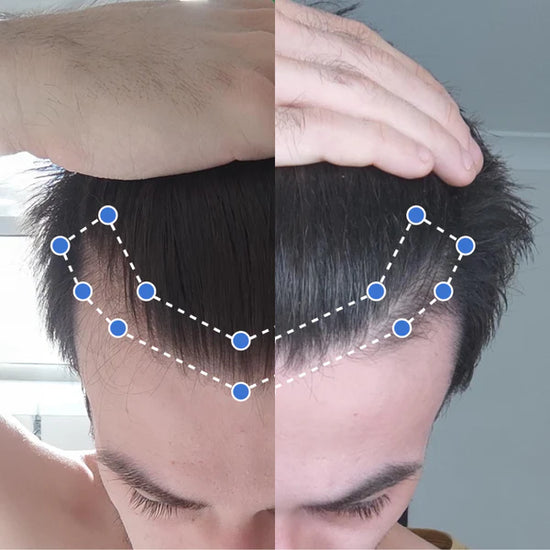 Transformación antes y después 3